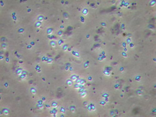 Bacillus Thuringiensis