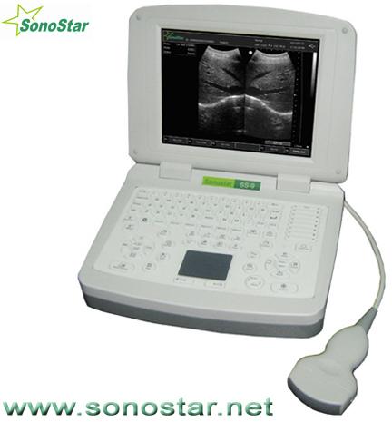 Ultrasound B Scanner - (SS-9)