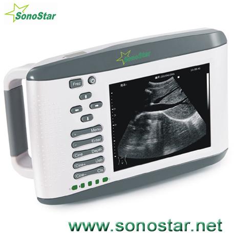 Ultrasound B Scanner - (SS-2)