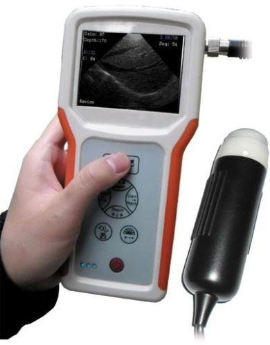 V1 Palm Ultrasound Scanner