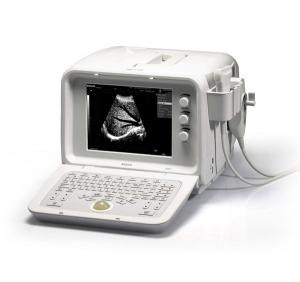 Digital Ultrasound System