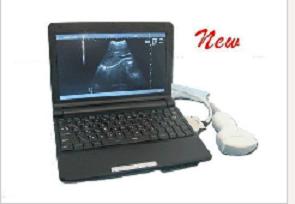 Laptop Ultrasound Scanner, Brand Name : kaier