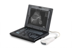 Notebook Ultrasound Scanner, Brand Name : NEUROCARE
