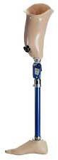 Above Knee Prosthesis