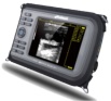 Palm Ultrasound Scanner
