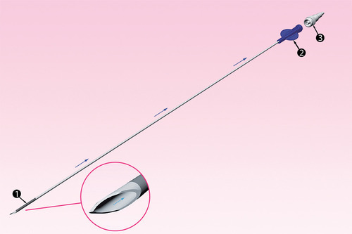 Cyst Aspiration Needle