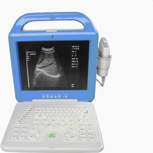 Laptop Ultrasound Scanner, Brand Name : CX