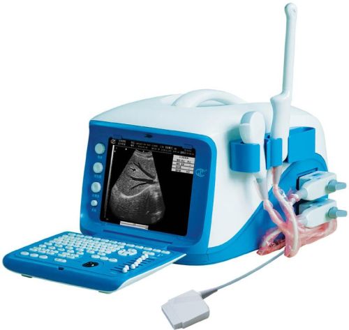 Portable Digital Ultrasound Scanner, Brand Name : CX