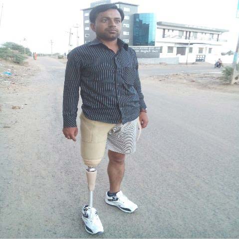 Stainless Steel Above Knee Prosthesis, For Orthopedic Surgery, Size : Standard