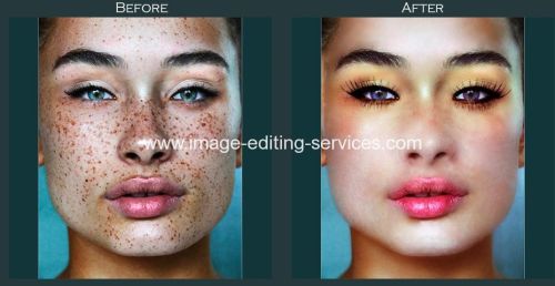 Picture Enhancement Service