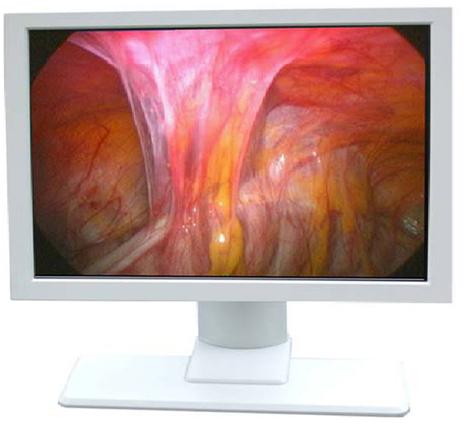 24 Surgical Grade LCD Display