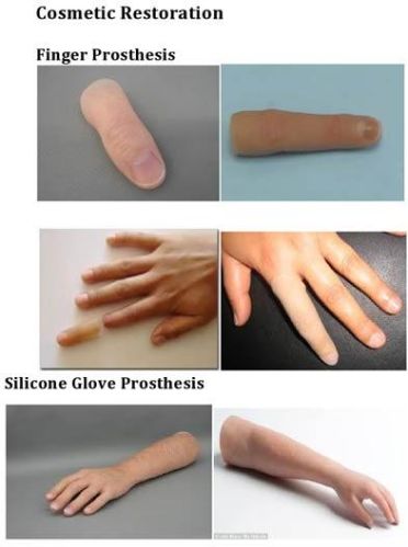 Finger Prosthesis