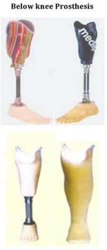 Artificial Limbs