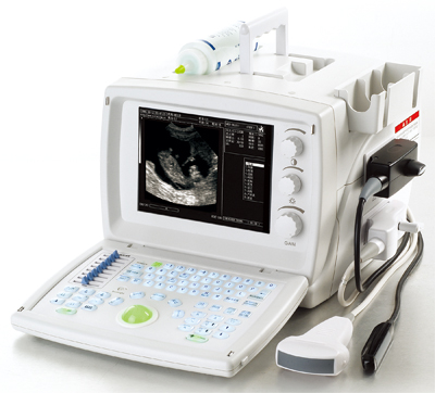 Digital Ultrasound System