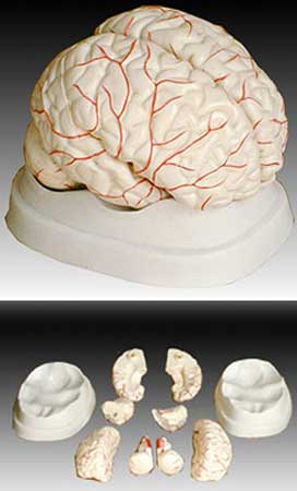 KK-047 Arterial Brain Model