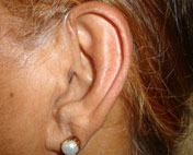 Openfit Hearing Aid