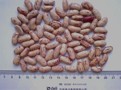 Light speckled kidney beans