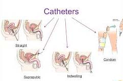 Disposable Catheters